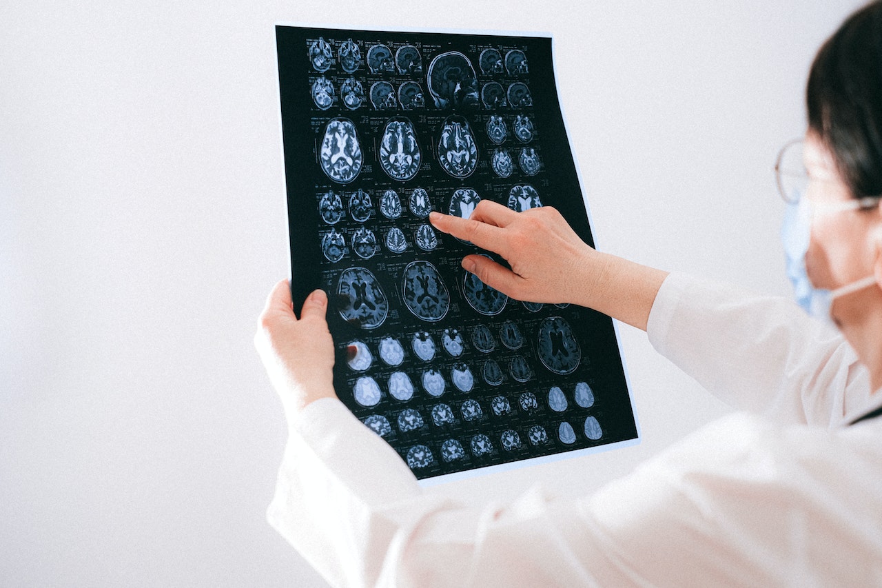 A doctor holding a print out of brain scans