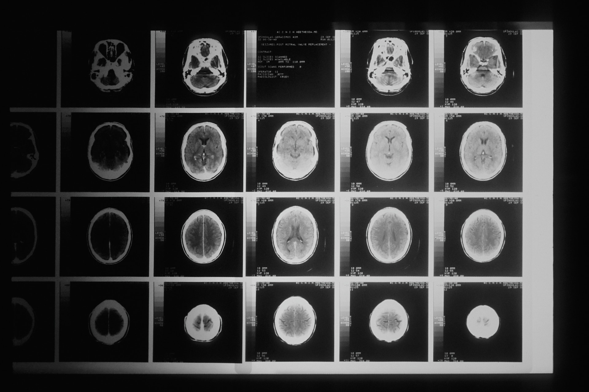 collection of brain scans
