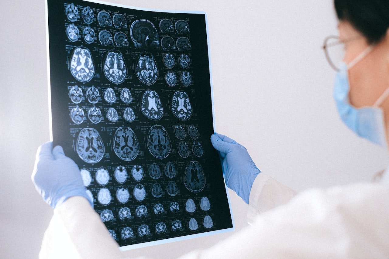doctor analysing brain scans