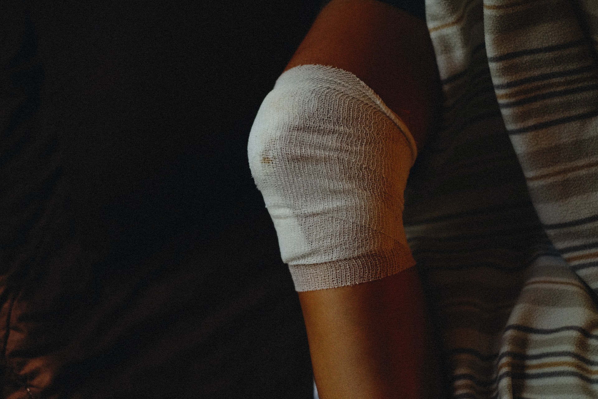 A bandaged arm