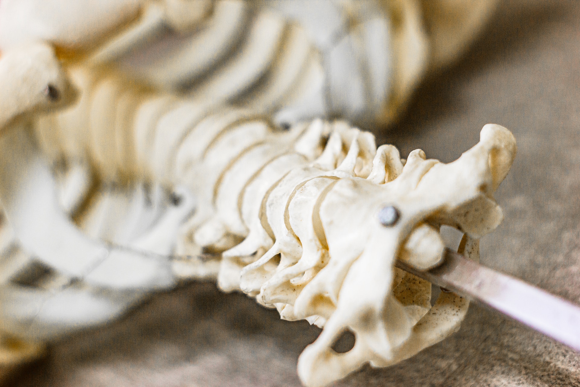 A 3D diagram of a spine