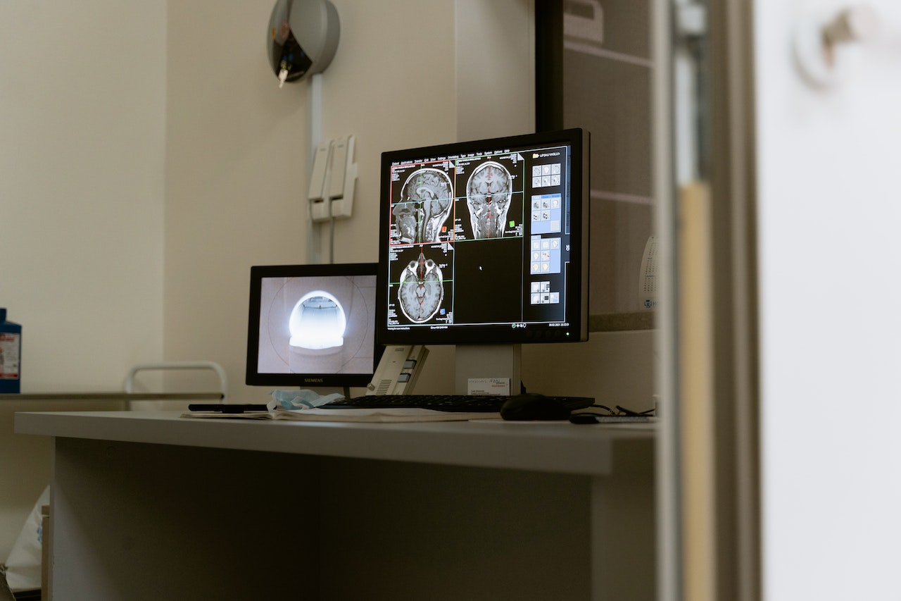 A screen showing brain scans
