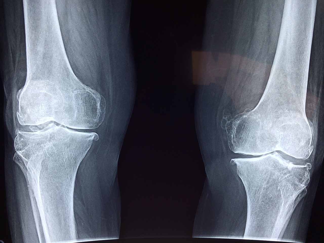 knee x ray