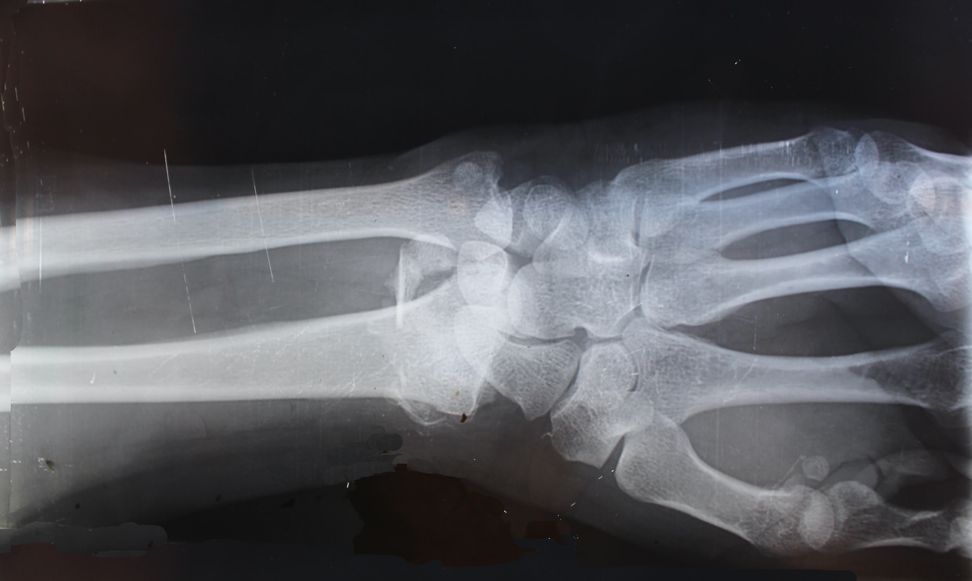 Wrist x ray
