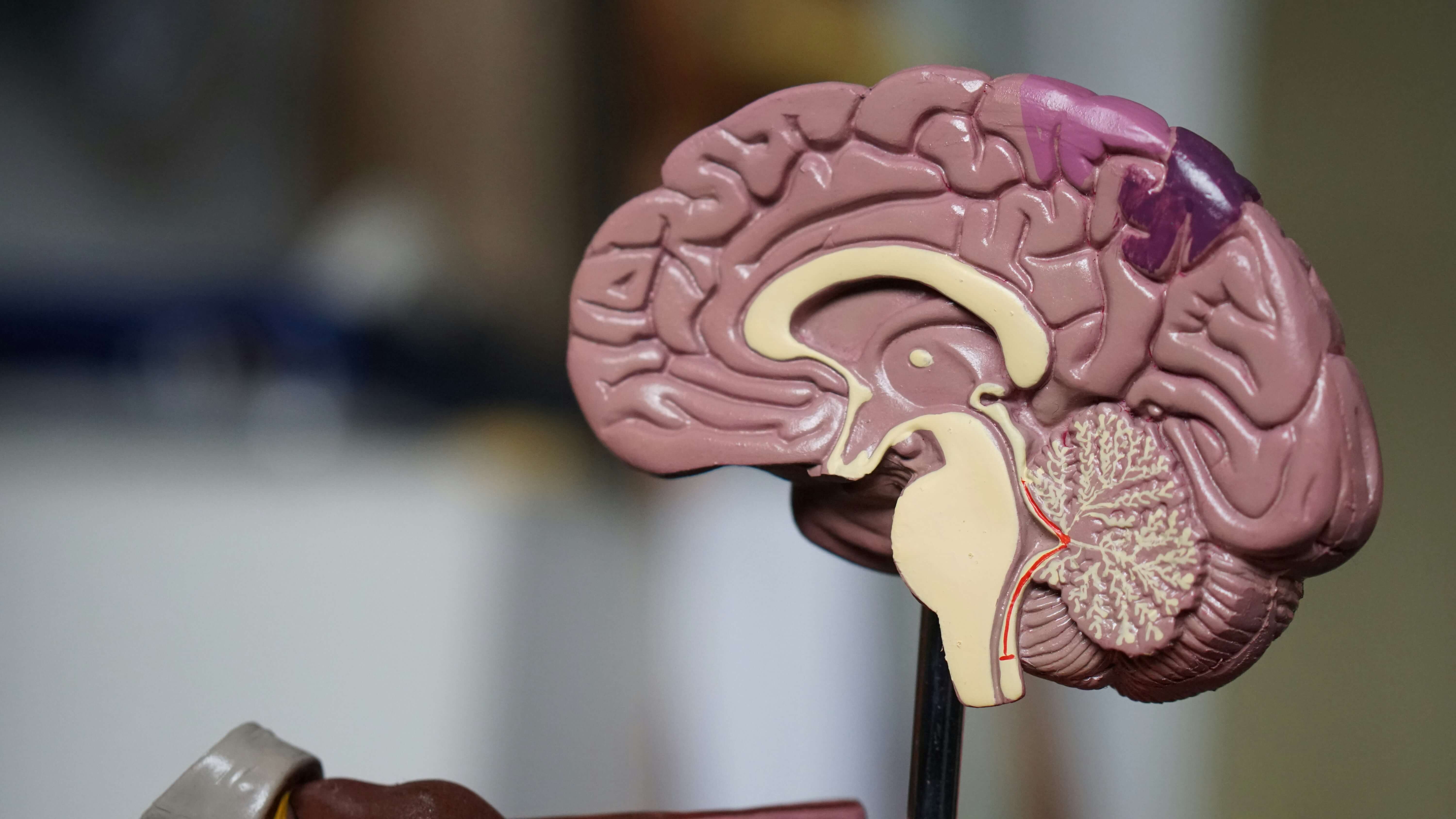 Drug Therapies for Brain